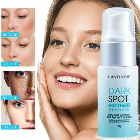 Dark Spot Cream Corrector Remover (30g)