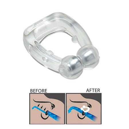 3 PCS Anti Snore Nose Clip